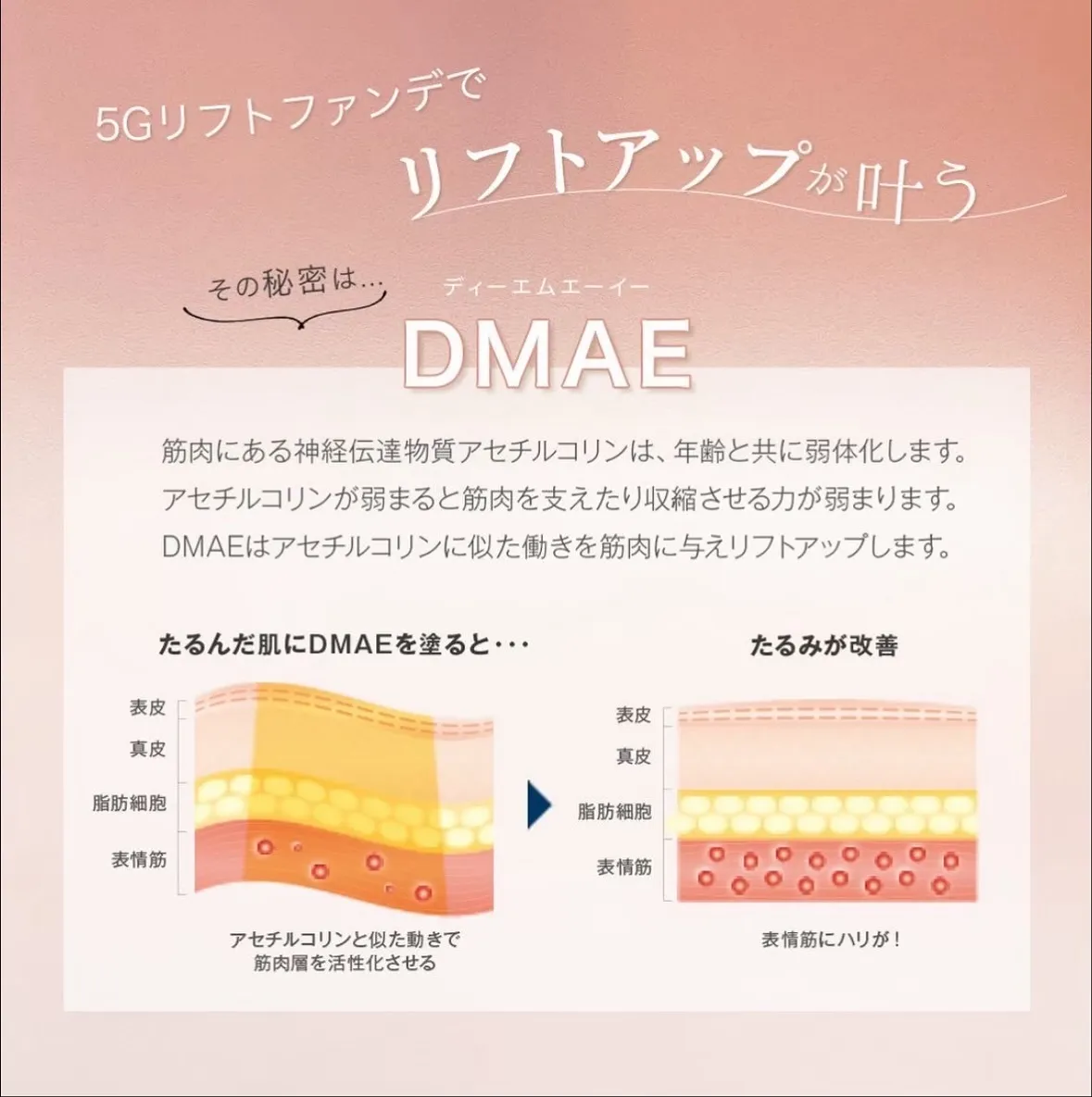 速攻60秒「塗る糸リフト」
