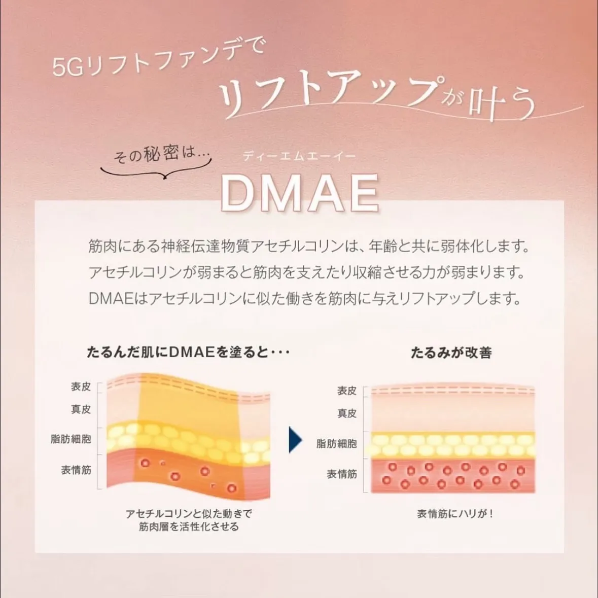 速攻60秒「塗る糸リフト」
