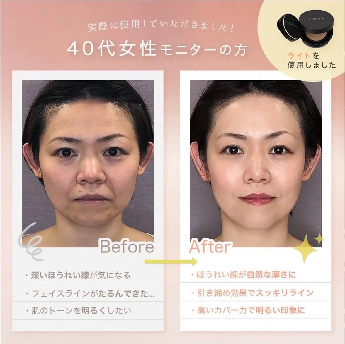 速攻60秒「塗る糸リフト」