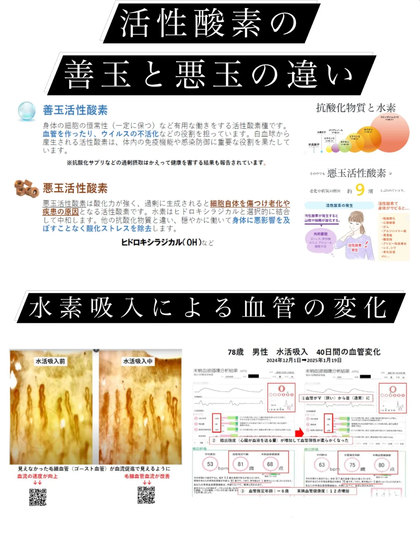 今回は活性酸素の善玉活性酸素と悪玉活性酸素の違いと水素による...