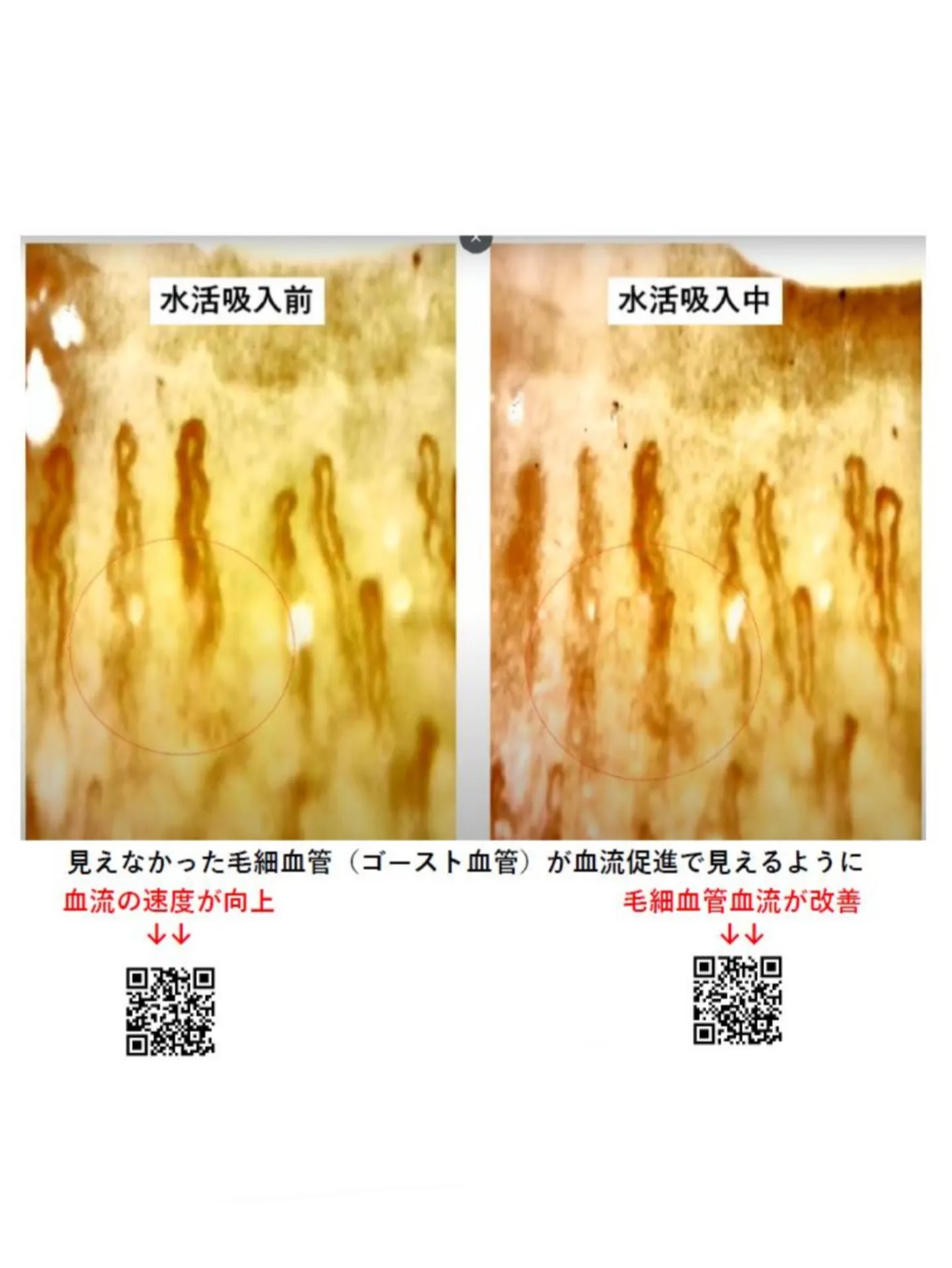 今回は活性酸素の善玉活性酸素と悪玉活性酸素の違いと水素による...